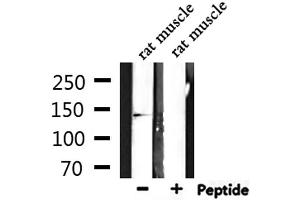 Western blot analysis of extracts from rat muscle, using RNF123 Antibody.