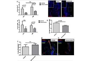 Quantitative analysis of immunofluorescence images shows the capability of Bevacizumab to reduce Reca1+ vessels and CD68-positive cells at 14 and 28d p.