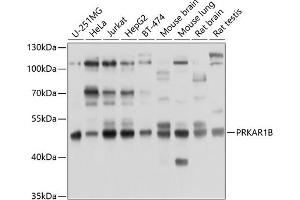 Western blot analysis of extracts of various cell lines, using PRKB antibody (ABIN6130039, ABIN6146193, ABIN6146194 and ABIN6214262) at 1:1000 dilution. (PRKAR1B anticorps  (AA 190-290))