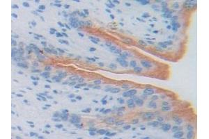 Detection of ATF6 in Mouse Vas Deferens Tissue using Polyclonal Antibody to Activating Transcription Factor 6 (ATF6)