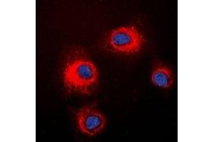Immunofluorescent analysis of STMN1 (pS16) staining in HeLa cells. (Stathmin 1 anticorps  (N-Term, pSer16))