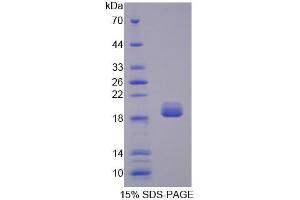SDS-PAGE analysis of Rat SHH Protein. (Sonic Hedgehog Protein (SHH))