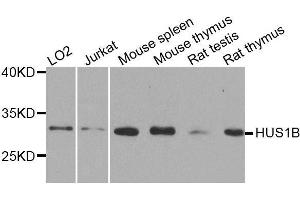 Western blot analysis of extracts of various cell lines, using HUS1B antibody.