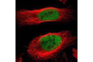 Immunofluorescent staining of U-2 OS with MCM4 polyclonal antibody  (Green) shows positivity in nucleus but excluded from the nucleoli. (MCM4 anticorps)