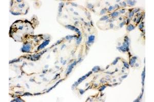 IHC-F: TGM2 antibody testing of human placental tissue