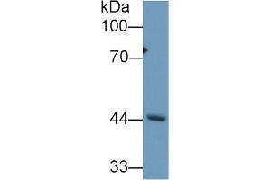 Detection of REV1 in Mouse Cerebrum lysate using Polyclonal Antibody to REV1 Homolog (REV1)