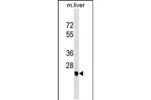 Western blot analysis in mouse liver tissue lysates (35ug/lane). (SGCD anticorps  (C-Term))