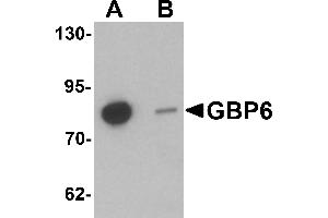 Western blot analysis of GBP6 in Hela cell lysate with GBP6 antibody at 0. (GBP6 anticorps  (C-Term))