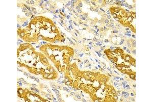 Immunohistochemistry of paraffin-embedded Human kidney using BIN1 Polyclonal Antibody at dilution of 1:100 (40x lens).