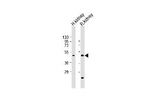 All lanes : Anti-KCNK12 Antibody (C-term) at 1:2000 dilution Lane 1: human kidney lysate Lane 2: rat kidney lysate Lysates/proteins at 20 μg per lane.