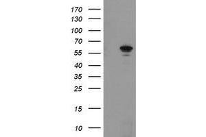 Western Blotting (WB) image for anti-Formiminotransferase Cyclodeaminase (FTCD) antibody (ABIN1496379)