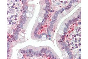 Anti-SLC25A19 antibody IHC staining of human small intestine. (SLC25A19 anticorps  (AA 236-263))