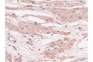 IHC-P analysis of Human Prostate Gland Tissue, with DAB staining. (Transgelin anticorps  (AA 1-201))