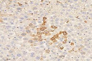 Immunohistochemistry analysis of paraffin-embedded mouse liver using,MRPL51 (ABIN7074649) at dilution of 1: 4000 (MRPL51 anticorps)