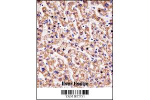 HYAL1 Antibody immunohistochemistry analysis in formalin fixed and paraffin embedded human liver tissue followed by peroxidase conjugation of the secondary antibody and DAB staining. (HYAL1 anticorps  (C-Term))