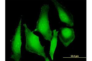 Immunofluorescence of purified MaxPab antibody to UBD on HeLa cell.