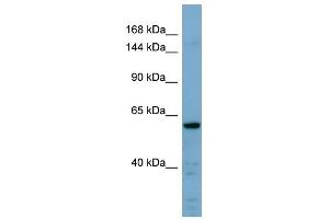 CDH23 antibody used at 1 ug/ml to detect target protein.