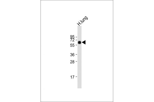 SLC24A4 Antikörper  (AA 344-378)