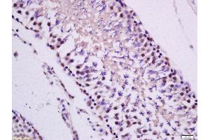 Formalin-fixed and paraffin embedded rat Testis tissue labeled with Anti-PKC epsilon Polyclonal Antibody, Unconjugated 1:300 followed by conjugation to the secondary antibody and DAB staining