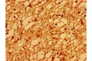 Immunohistochemistry of paraffin-embedded human brain tissue using ABIN7171099 at dilution of 1:100 (SV2A anticorps  (AA 36-149))