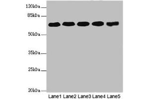 Western blot All lanes: KPNA6 antibody at 4. (KPNA6 anticorps  (AA 277-536))