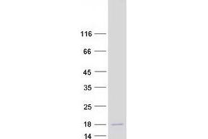 Validation with Western Blot