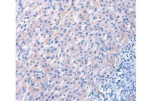 Immunohistochemistry (IHC) image for anti-Epidermal Growth Factor (EGF) antibody (ABIN3016522)