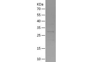 Western Blotting (WB) image for TBC1 Domain Family, Member 22A (TBC1D22A) (AA 2-280) protein (His tag) (ABIN7125328)
