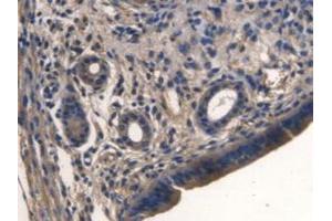 IHC-P analysis of Mouse Uterus Tissue, with DAB staining. (TMEM27 anticorps  (Leu222))