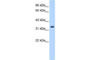 WB Suggested Anti-NCF4 Antibody Titration:  0. (NCF4 anticorps  (N-Term))
