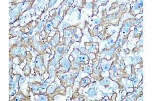 Immunohistochemistry of paraffin-embedded Rat placenta using GLUT1/SLC2 antibody (ABIN6129475, ABIN6147954, ABIN6147956 and ABIN6222743) at dilution of 1:100 (40x lens). (GLUT1 anticorps  (AA 210-310))