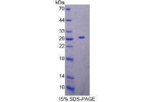 SDS-PAGE analysis of Human MTF1 Protein. (MTF1 Protéine)