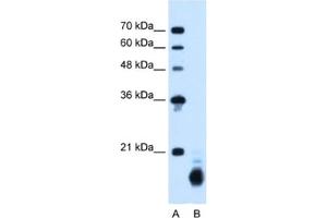 Western Blotting (WB) image for anti-Cyclophilin B (PPIB) antibody (ABIN2462813) (PPIB anticorps)