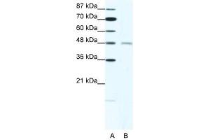 CHRND antibody (20R-1325) used at 1. (CHRND anticorps  (N-Term))
