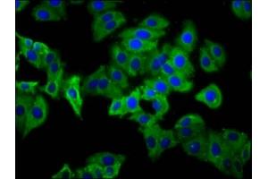 Immunofluorescence staining of HepG2 cells with ABIN7163104 at 1:133, counter-stained with DAPI. (PHEX anticorps  (AA 524-673))