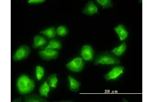 Immunofluorescence of monoclonal antibody to TUBA2 on HeLa cell.