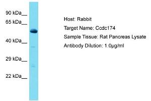 Host: Rabbit Target Name: Ccdc174 Sample Type: Rat Pancreas lysates Antibody Dilution: 1. (CCDC174 anticorps  (Middle Region))