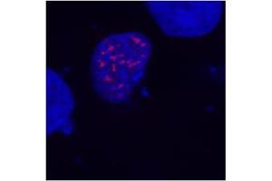 Fig. (DDDDK Tag anticorps)