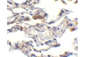anti-Baculoviral IAP Repeat Containing 2 (BIRC2) (C-Term) antibody