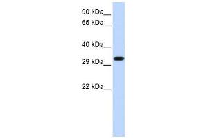 SIP1 antibody used at 1 ug/ml to detect target protein. (SIP1 anticorps  (Middle Region))