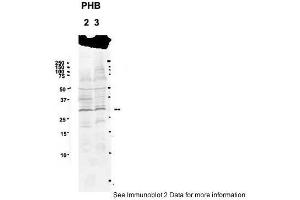 Sample Type: 2. (Prohibitin anticorps  (C-Term))