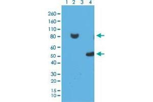 Western blot analysis of 293T cell Lane 1: untransfected with His-Tag fusion protein X, Lane 2: transfected with His-Tag fusion protein X, Lane 3: E.
