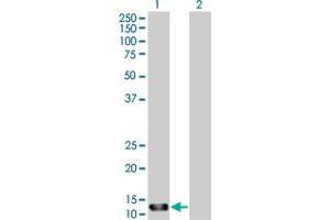 Western Blot analysis of STK10 expression in transfected 293T cell line by STK10 MaxPab polyclonal antibody. (STK10-A anticorps  (AA 12-144))