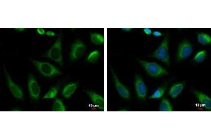 ICC/IF Image PRKCSH antibody [N1C1] detects PRKCSH protein at endoplasmic reticulum by immunofluorescent analysis. (PRKCSH anticorps)