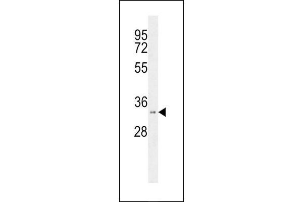 HSD17B11 anticorps  (N-Term)