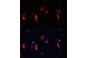 Immunofluorescence analysis of C6 cells using Cathepsin L/V/K/H antibody (ABIN6127670, ABIN6139235, ABIN6139237 and ABIN6215636) at dilution of 1:100.