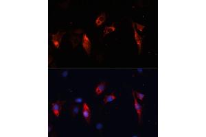 Immunofluorescence analysis of C6 cells using Cathepsin L/V/K/H antibody (ABIN6127670, ABIN6139235, ABIN6139237 and ABIN6215636) at dilution of 1:100. (Cathepsin L anticorps  (AA 114-333))