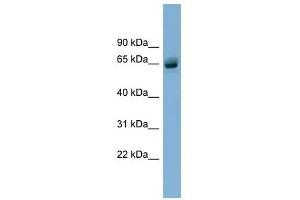 SLFN12 antibody used at 1 ug/ml to detect target protein. (SLFN12 anticorps  (N-Term))