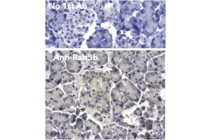Immunohistochemistry (IHC) image for anti-RAB5B, Member RAS Oncogene Family (RAB5B) (C-Term) antibody (ABIN1439995)