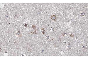ABIN6278814 at 1/100 staining human brain tissue sections by IHC-P.